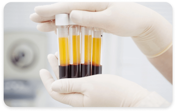 PRP-терапія статевого члена, урологія в клініці Di Clinic у Києві 2